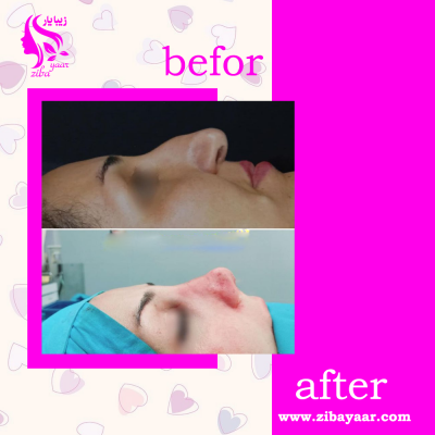 نمونه اجرا دکتر بهمن قمری
