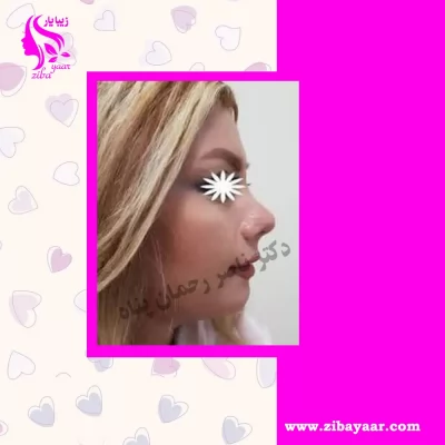 نمونه عمل شده دکتر ناصر رحمان پناه 