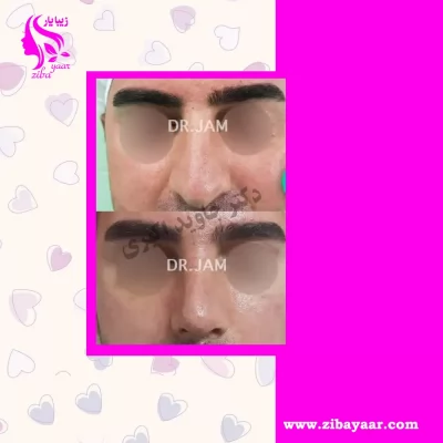 نمونه عمل دکتر اکبری