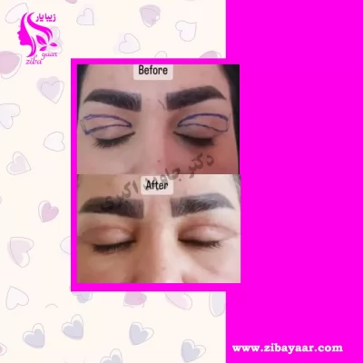 نمونه جراحی شده دکتر جاوید اکبری